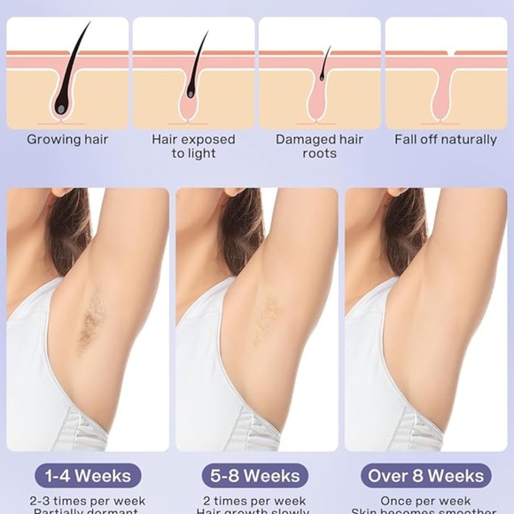 New Permanent Laser Hair Removal Device - Picture 4 of 6